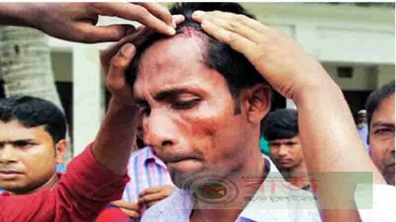 নেশা করতে বাধা দেয়ায় শিক্ষককে মারধর করল ছাত্র ও তার স্বজনরা নেশা করতে বাধা দেয়ায় শিক্ষককে মারধর করল ছাত্র ও তার স্বজনরা