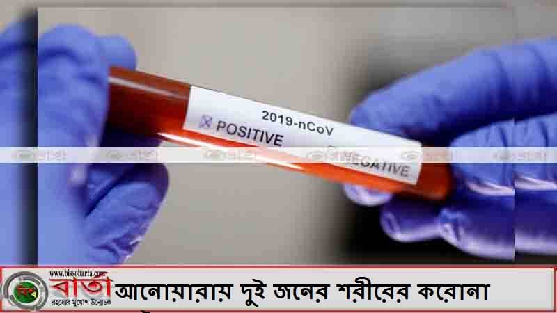 আনোয়ারায় দুই জনের শরীরের করোনা ভাইরাস শনাক্ত আনোয়ারায় দুই জনের শরীরের করোনা ভাইরাস শনাক্ত